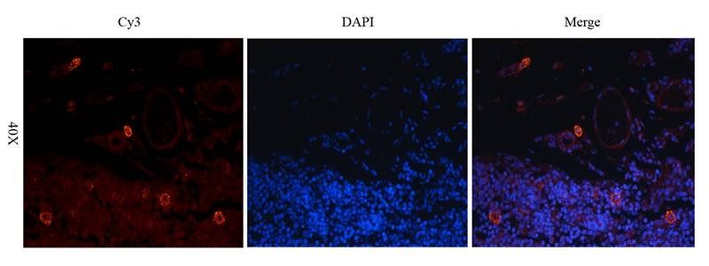 LC3 antibody