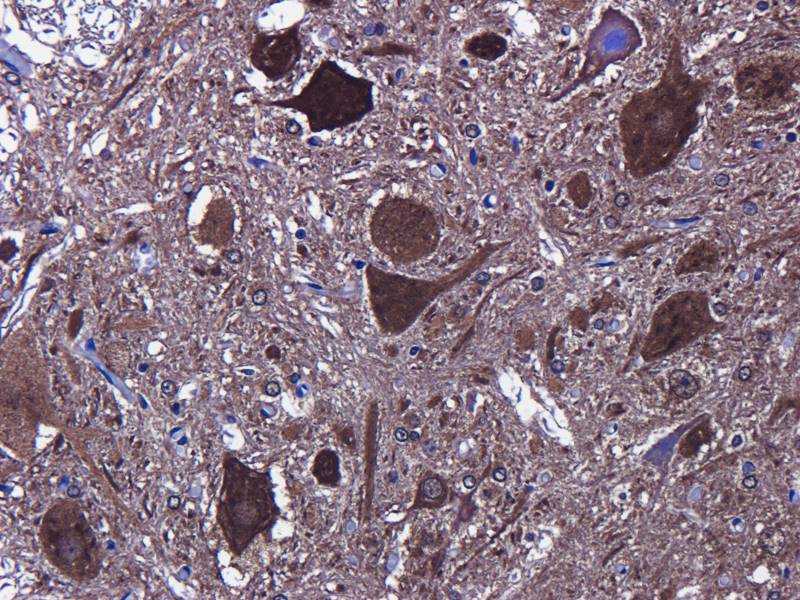 LC3 antibody