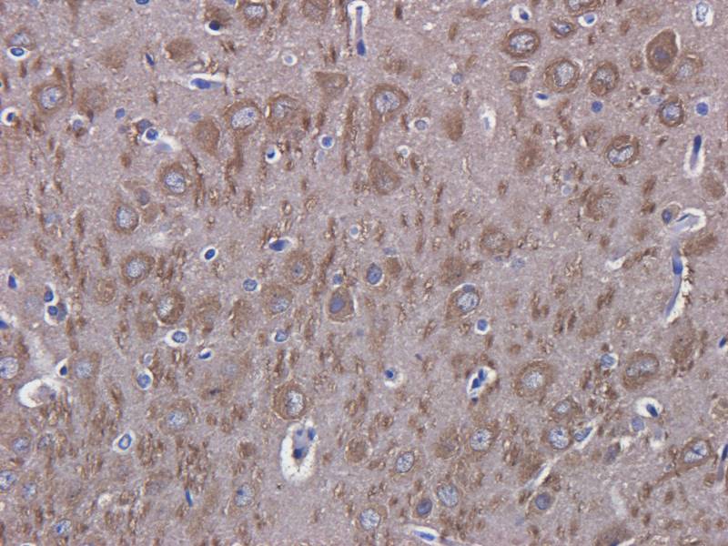 LC3 antibody