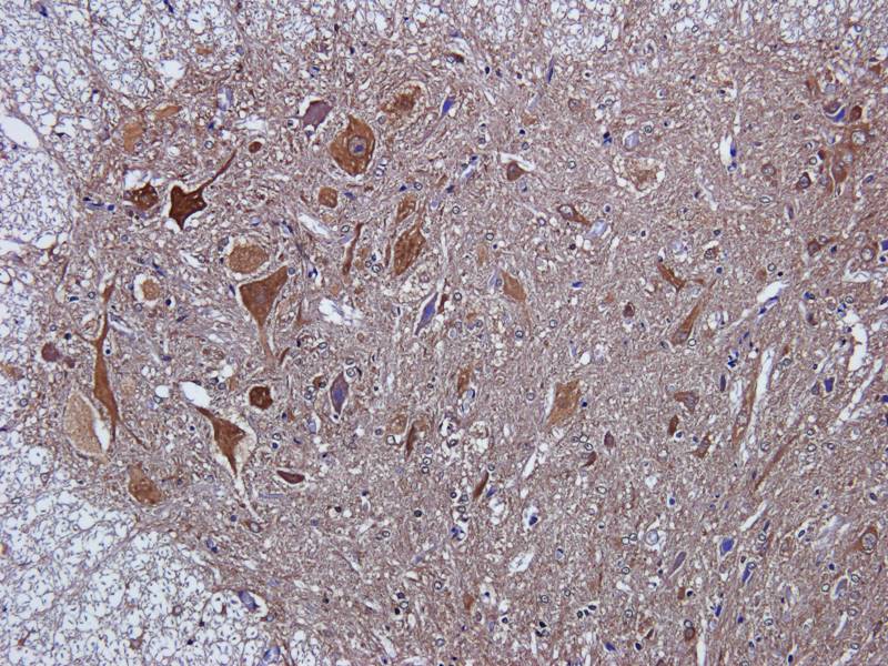 LC3 antibody