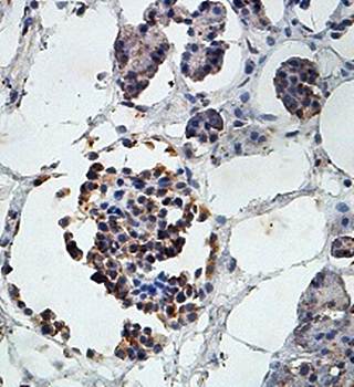 LCA5 Rabbit Polyclonal Antibody
