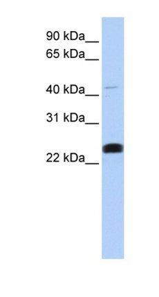 LCLAT1 antibody