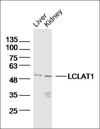 LCLAT1 antibody