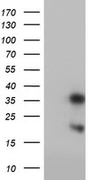 LCMT1 Antibody