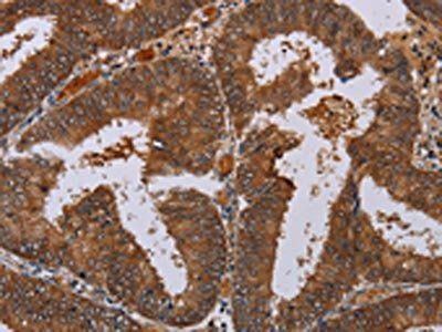 LCMT1 antibody