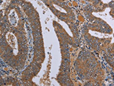 LCMT1 Antibody