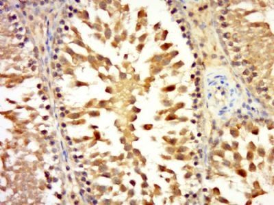 LCMT1 Rabbit Polyclonal Antibody