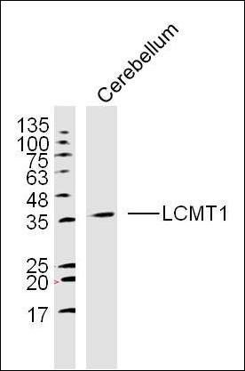 LCMT1 Rabbit Polyclonal Antibody