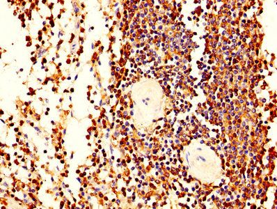 LCP1 Antibody