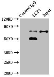 LCP1 Antibody