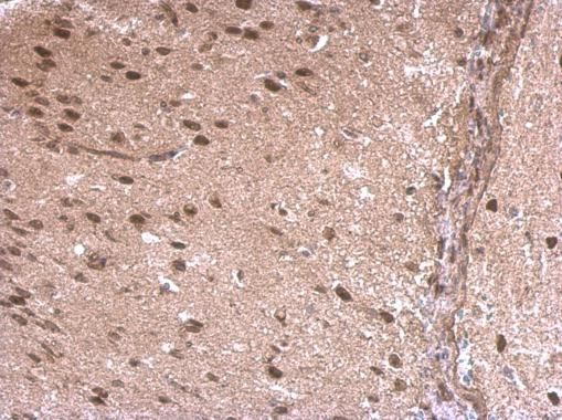 LDB1 antibody [N2C3]