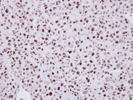 LDB1 antibody [N2C3]
