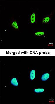 LDB1 antibody