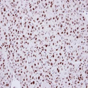 LDB1 antibody