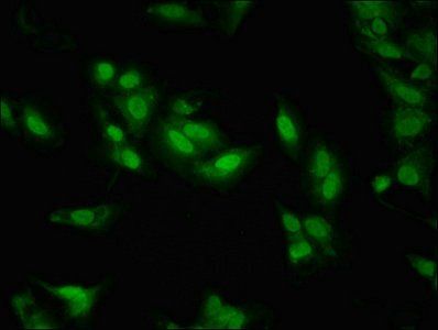 LDB1 antibody