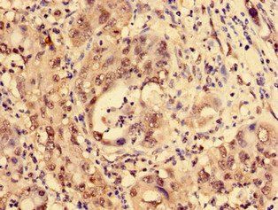 LDB1 Antibody