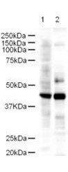 LDB2 antibody