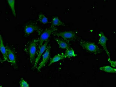 LDHC Antibody