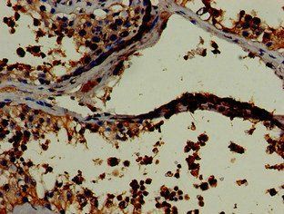 LDHC Antibody