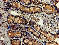 LDHC Antibody
