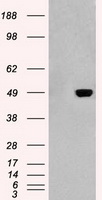 LDLR Antibody