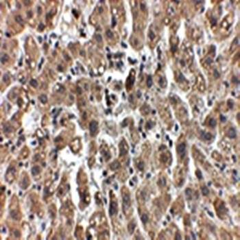 LDL-R Antibody