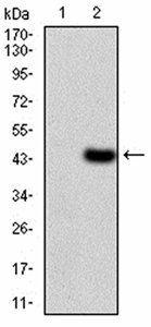 LDLR Antibody