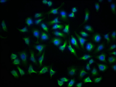 LDLR Recombinant Monoclonal Antibody