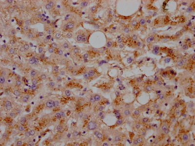 LDLR Recombinant Monoclonal Antibody
