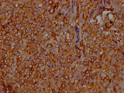LDLR Recombinant Monoclonal Antibody