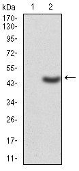 LDLR Antibody