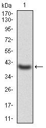 LDLR Antibody