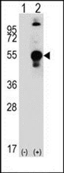 LECT1 antibody