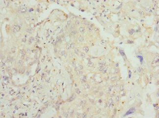 CNMD Antibody