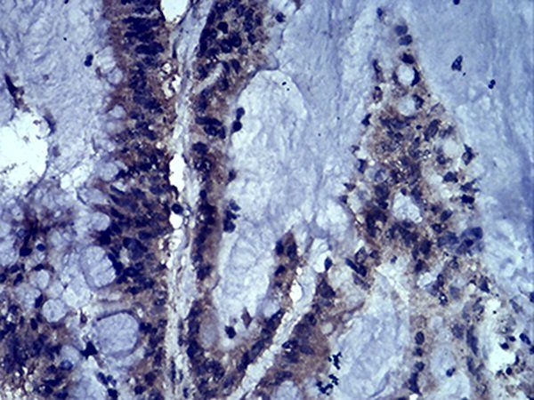 LEF1 Antibody