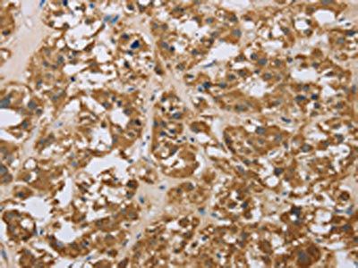 LEF1 Antibody