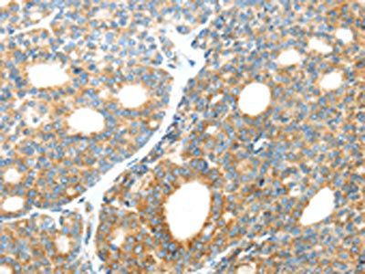 LEFTY2 Antibody