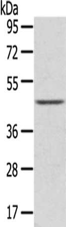 LEFTY2 antibody