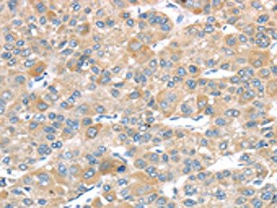 LEFTY2 Antibody