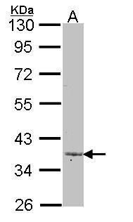 LEFTY2 antibody
