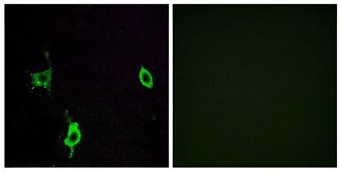 LAMC3 Antibody