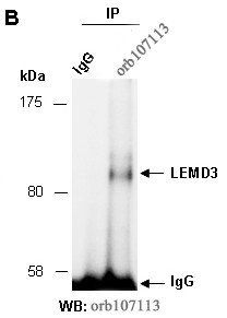 LEMD3 antibody