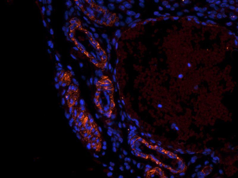 Leptin antibody