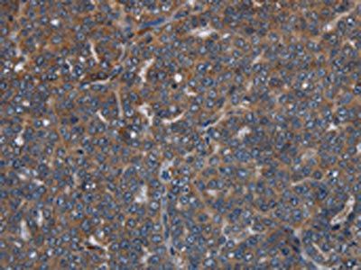 LETMD1 Antibody