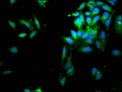 Leukocyte elastase inhibitor antibody