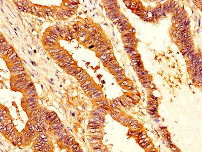 SERPINB1 Antibody