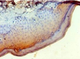 Leukocyte elastase inhibitor antibody