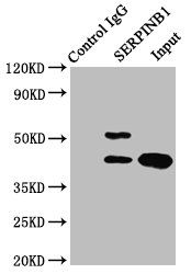 Leukocyte elastase inhibitor antibody