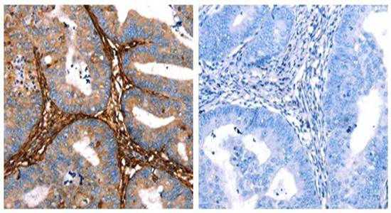 LGALS1 Rabbit Polyclonal Antibody