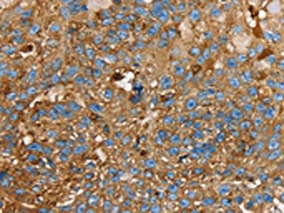 LGALS3BP Antibody